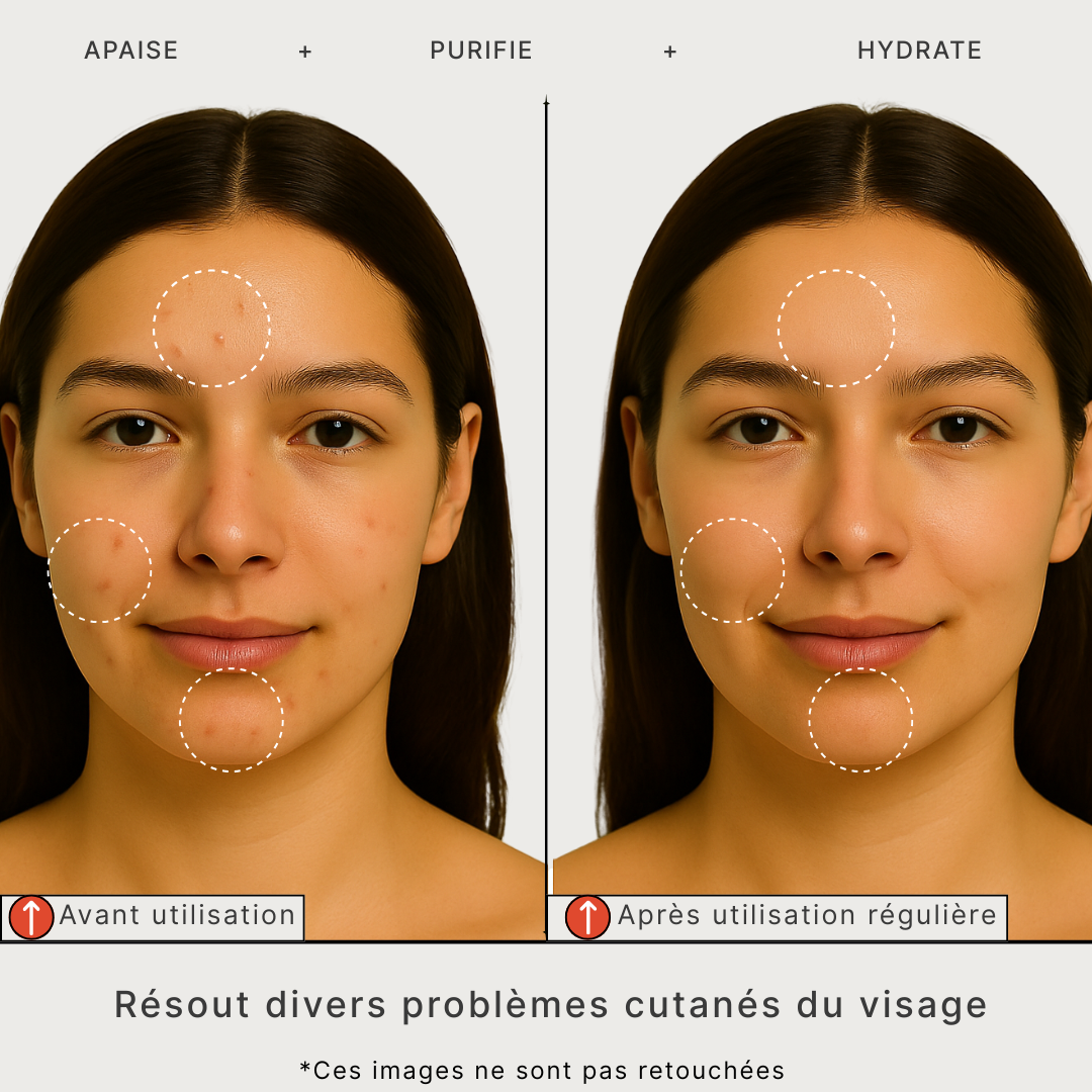 Masque Thé Vert Apaisant