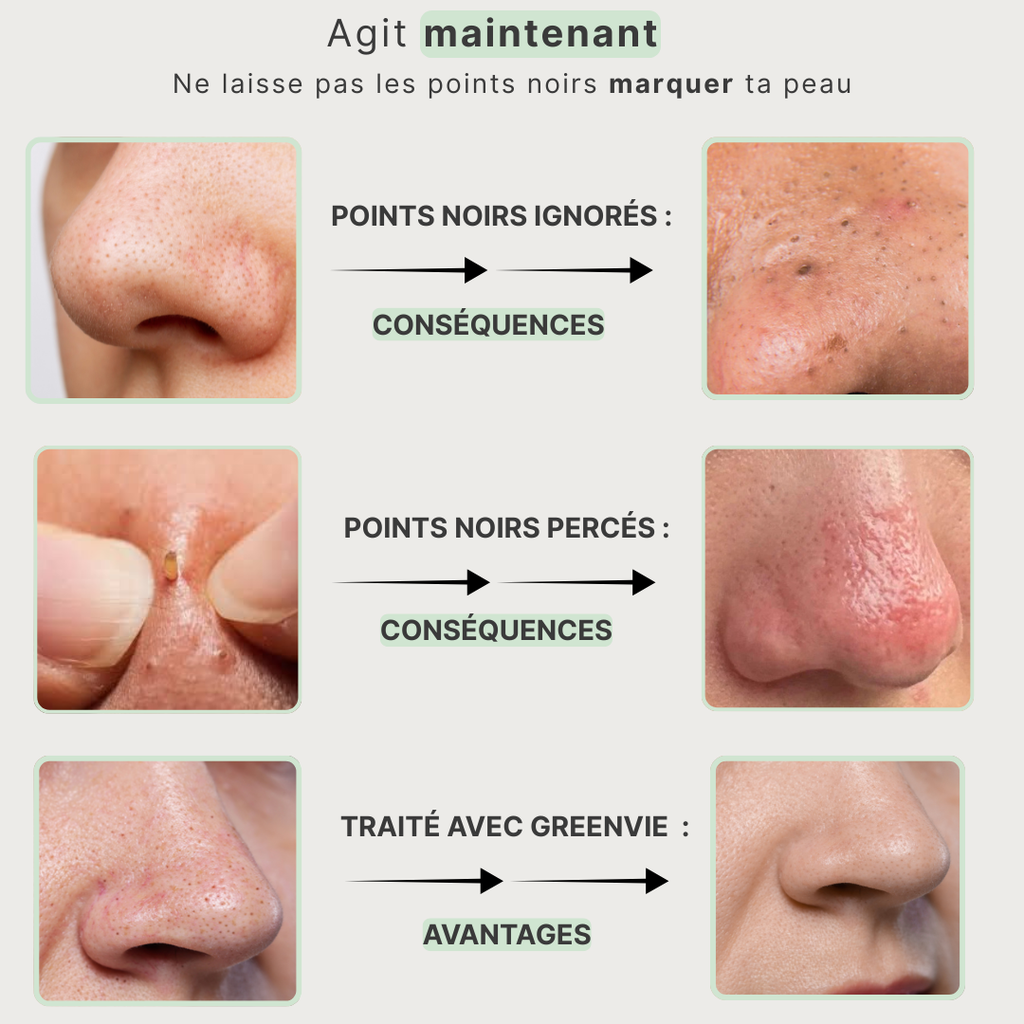 Masque Détox au Thé Vert