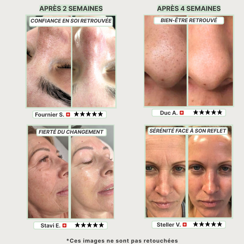 Masque Détox au Thé Vert