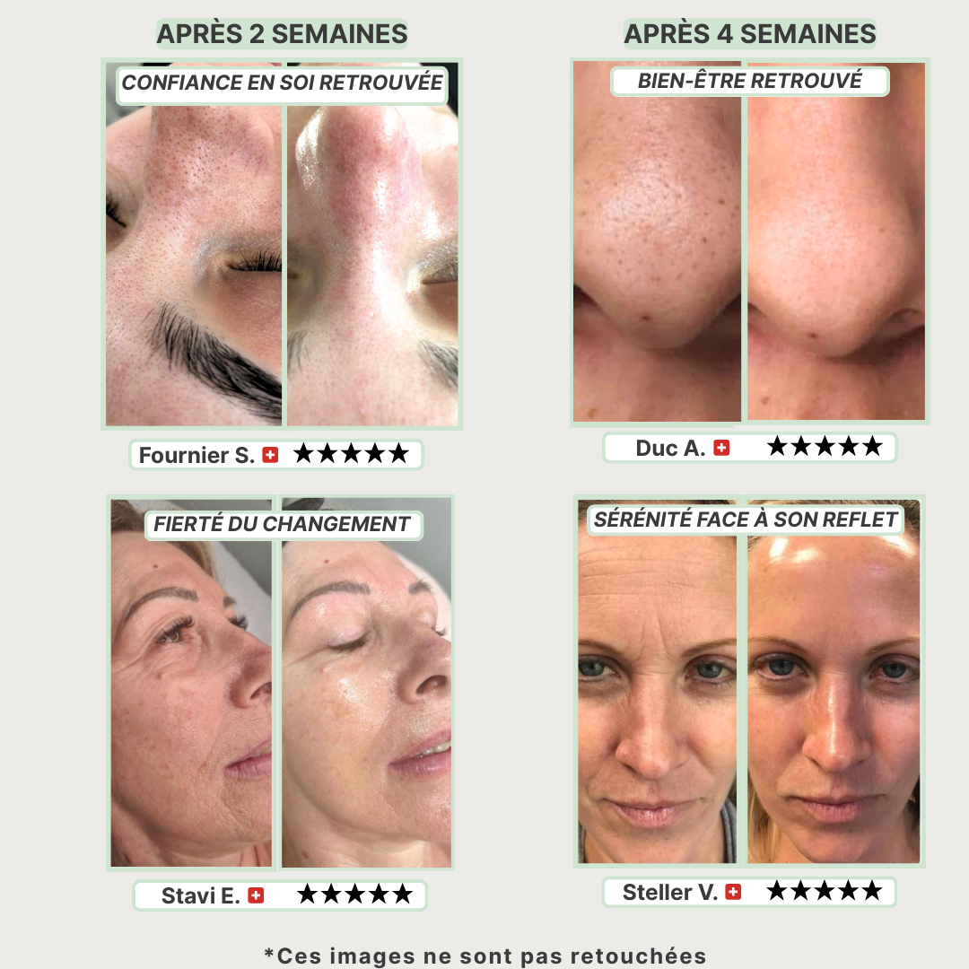 Masque Détox au Thé Vert