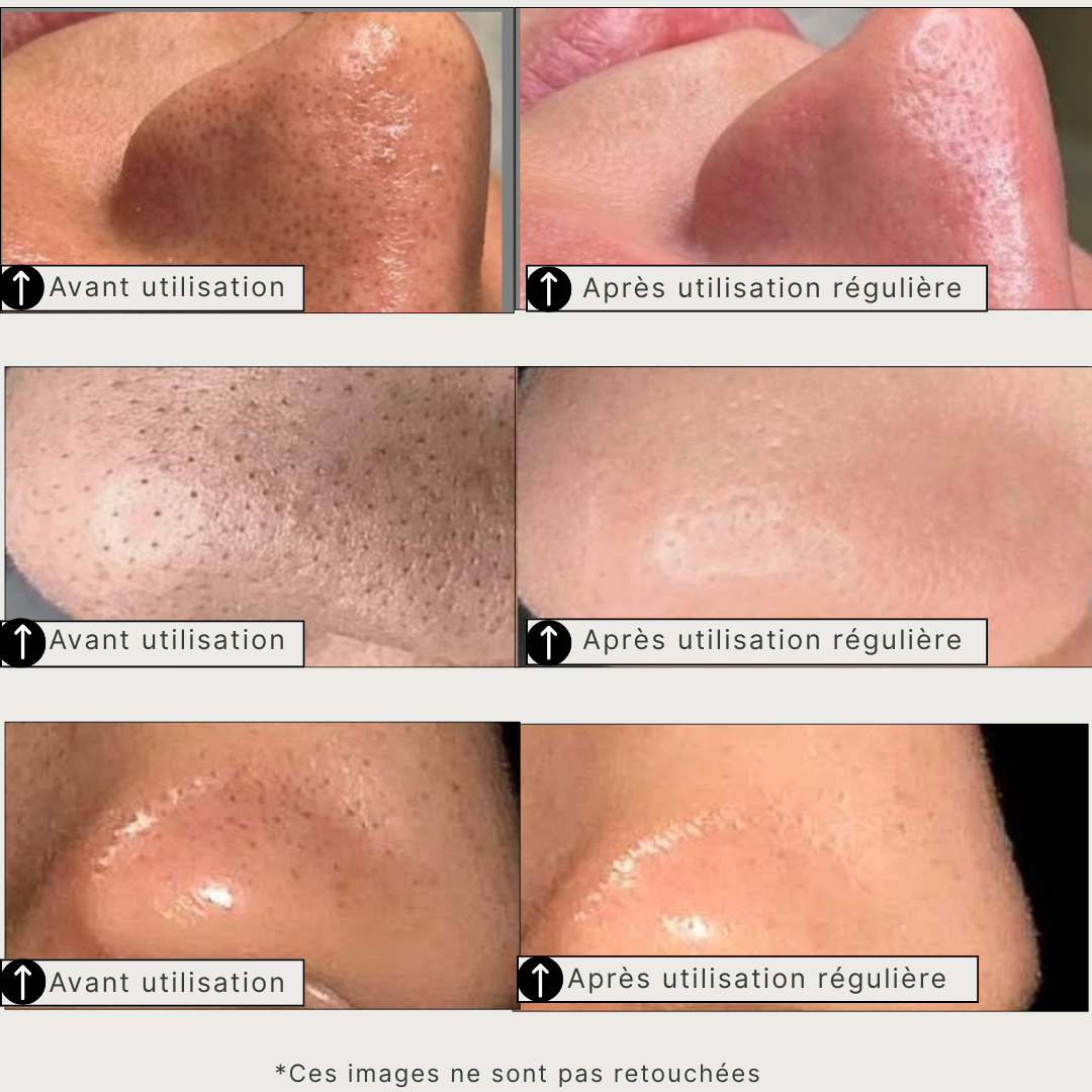 Masque Détox au Thé Vert