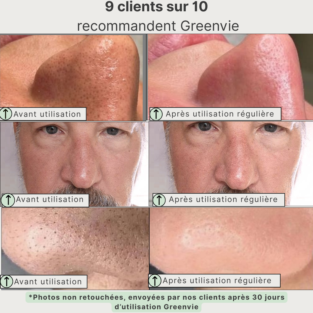Masque Détox au Thé Vert