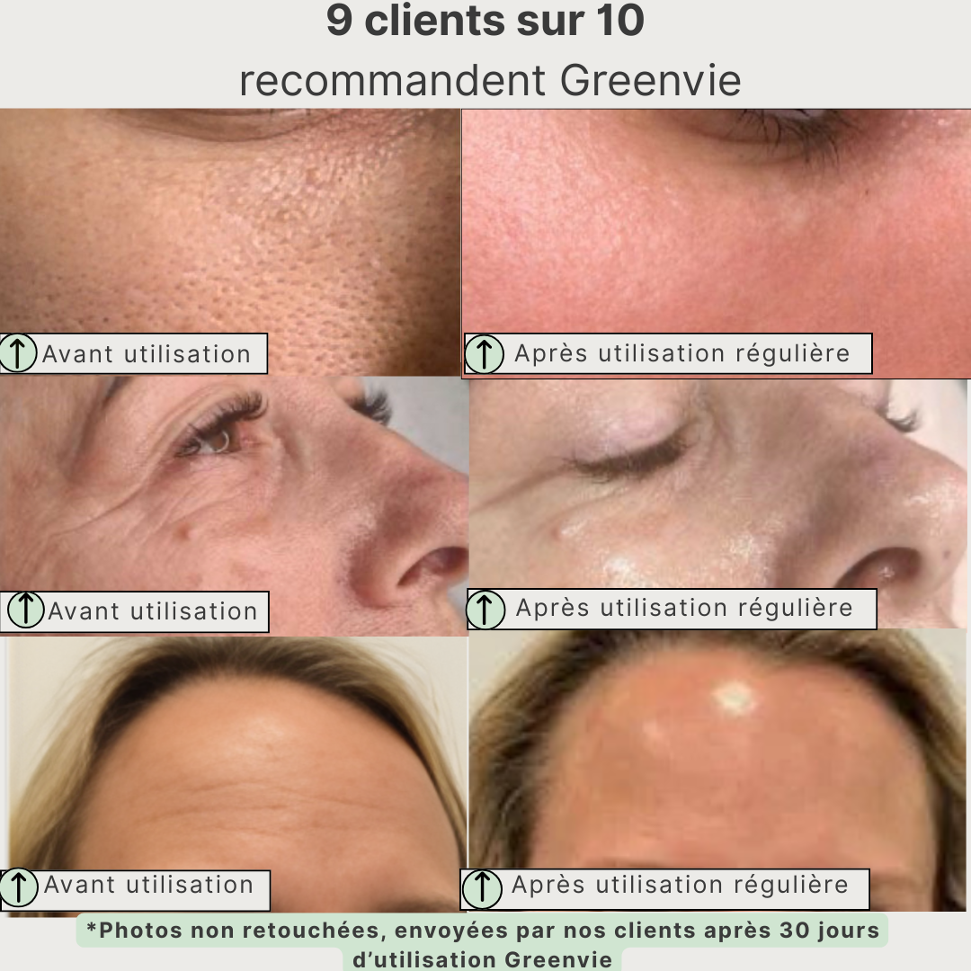 Masque Détox au Thé Vert