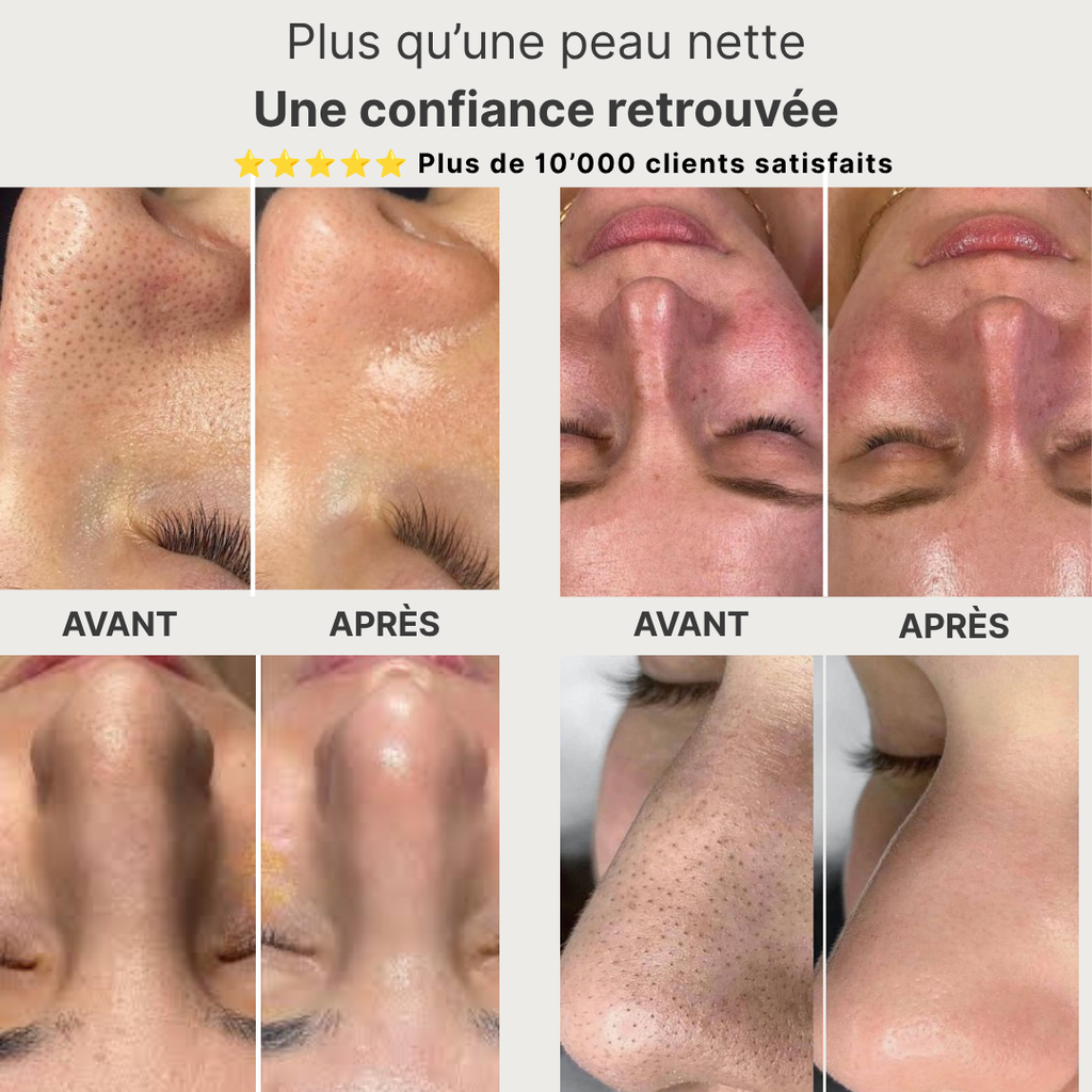 Masque Détox au Thé Vert