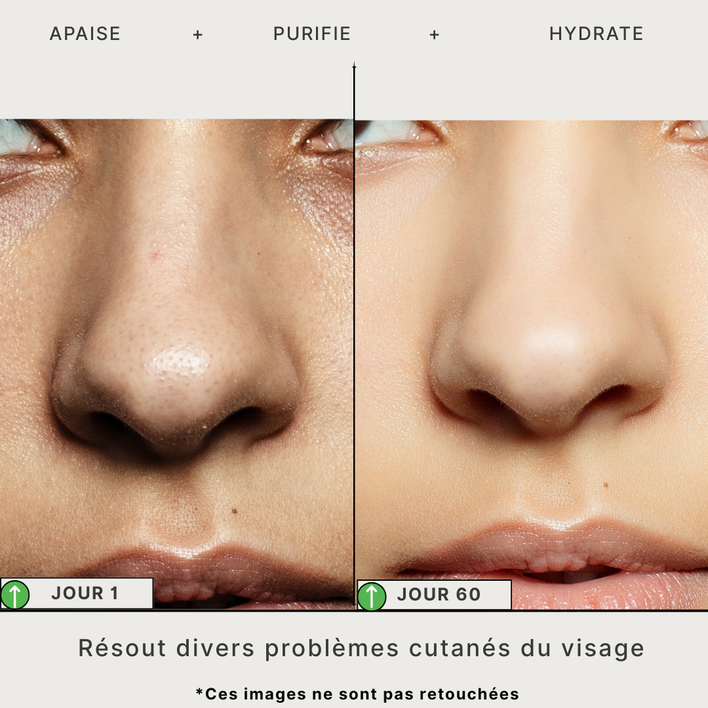 Masque Détox au Thé Vert