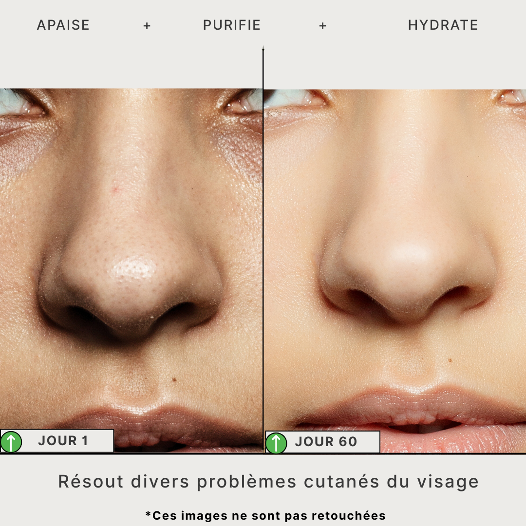 Masque Détox au Thé Vert